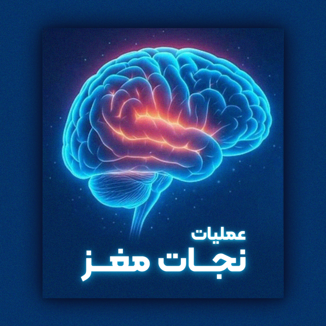 عملیات نجات مغز